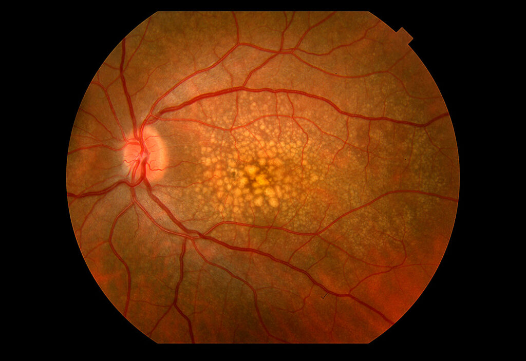 retina-center