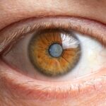 Signs You May Need Cataract Eye Surgery