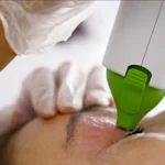 Why Private Cataract Surgery Cost Varies Between Surgeons