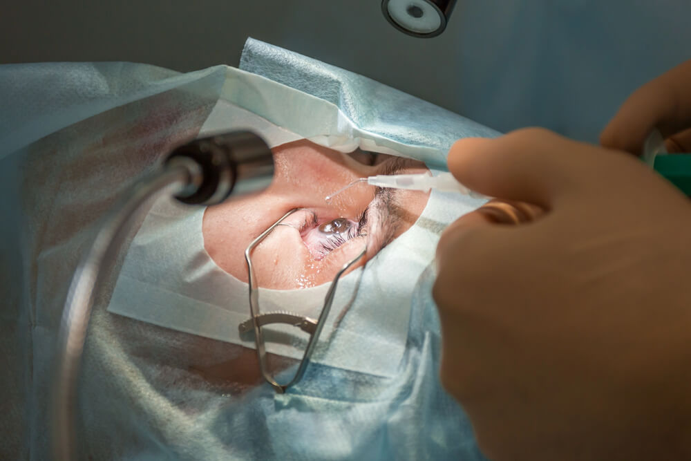 How Much Does Glaucoma Surgery Cost In Australia On Average?